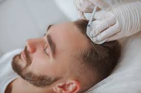 PRP Skin Rejuvenation Cost in Islamabad: Complete Guide