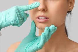 What Is Nose Surgery and How Does It Work in Islamabad