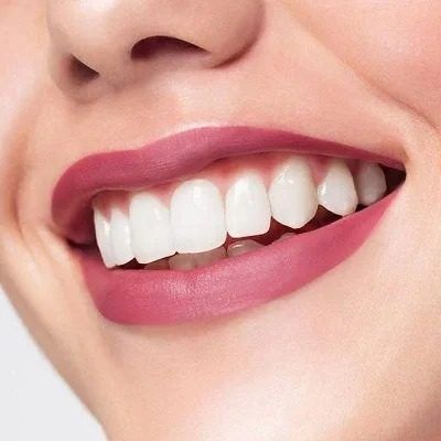 Top-Rated Teeth Whitening Specialists in Islamabad